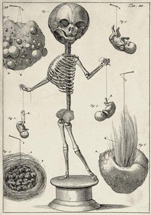 Skeleton with Foetal Puppets llustration by Dutch anatomist Frederik Ruysch