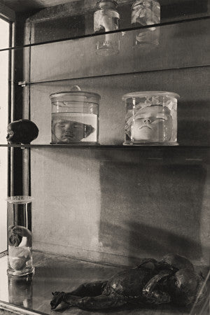 Vintage photograph of an anatomy cupboard, with jars containing preserved heads and anatomical specimens